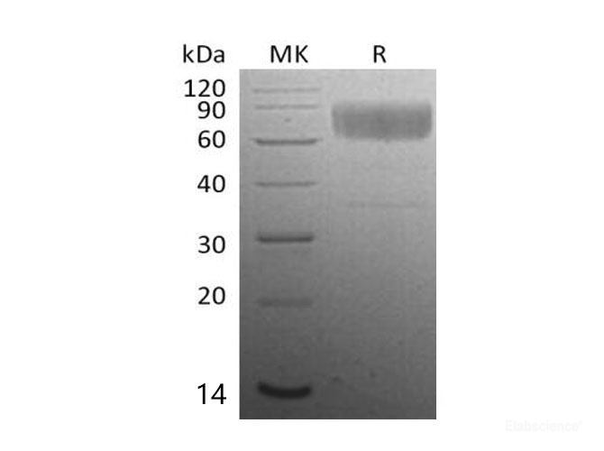 Recombinant Mouse IAP/OA3/CD47 Protein(C-Fc) -Elabscience