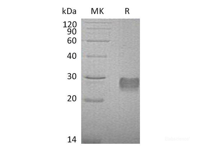 Recombinant Mouse IGF Binding Protein 6/IGFBP-6 Protein(C-6His) -Elabscience
