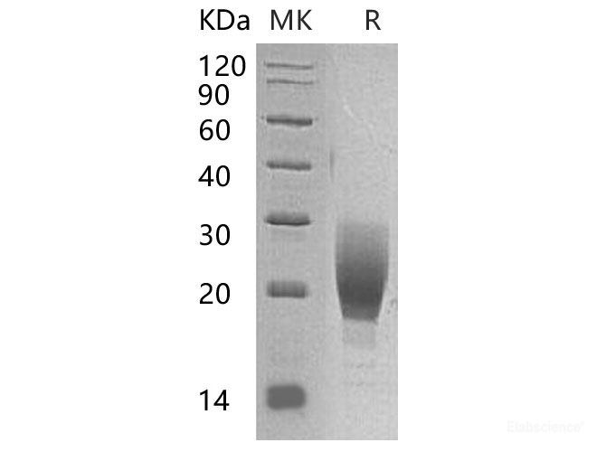 Recombinant Mouse IL-1 Receptor Type 1/IL-1R-1 Protein(C-Fc) -Elabscience