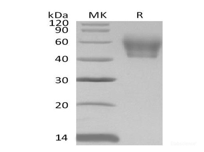 Recombinant Mouse IL-1 Receptor Type 2/IL-1 RII Protein(C-6His) -Elabscience