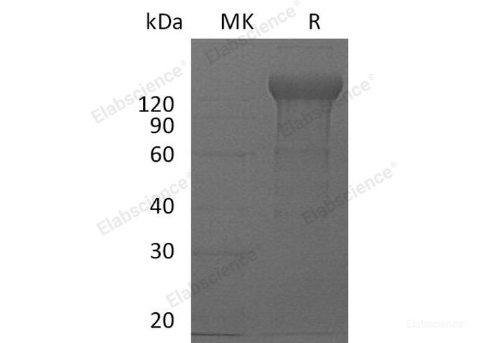 Recombinant Mouse IL-12 Receptor Subunit β2/IL-12RB2 Protein(C-Fc) -Elabscience