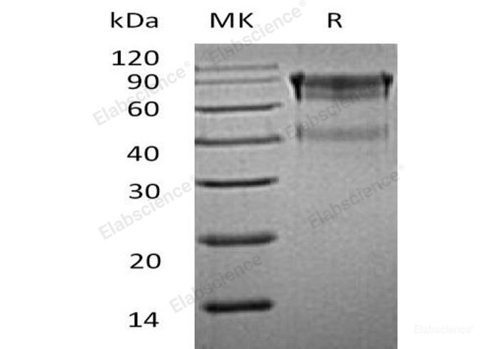 Recombinant Mouse IL-15 Receptor Subunit α/CD215/IL-15RA Protein(C-Fc)-Elabscience
