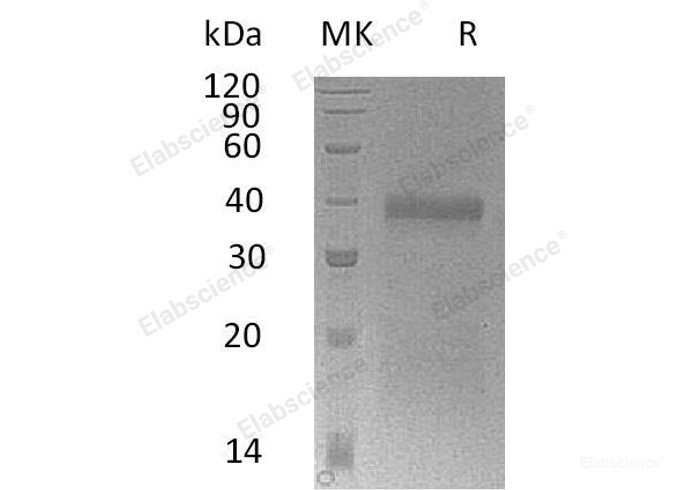Recombinant Mouse Insulin-like Growth Factor-Binding Protein 5/IGFBP5 Protein(C-6His) -Elabscience