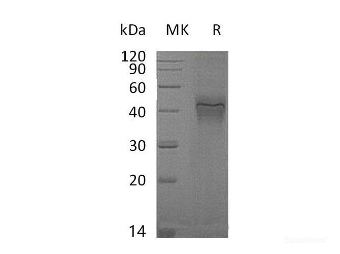 Recombinant Mouse Interferon γ Receptor 1/IFN-γ R1/CD119 Protein(C-6His) -Elabscience
