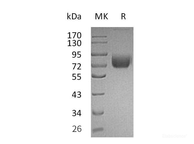 Recombinant Mouse Interferon γ Receptor 1/IFN-γ R1/CD119 Protein(C-Fc) -Elabscience