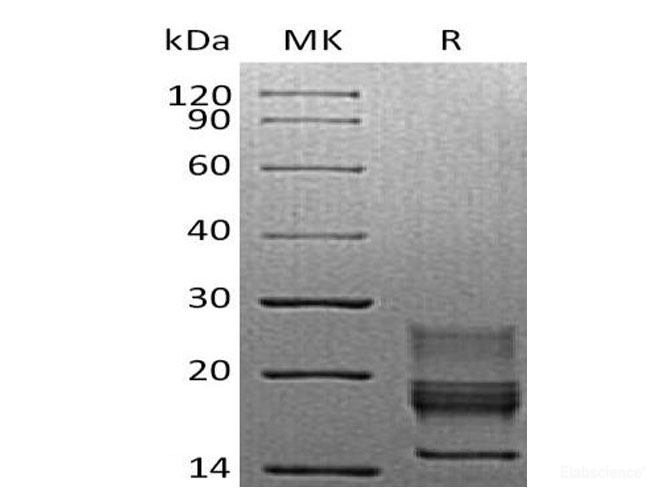 Recombinant Mouse Interferon γ/IFN-γ Protein(C-6His) -Elabscience