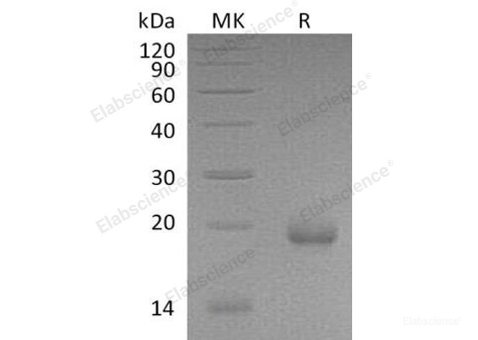 Recombinant Mouse Interferon ζ/IFN-ζ/Limitin Protein(C-6His) -Elabscience