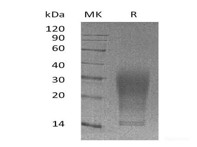 Recombinant Mouse Interleukin-13/IL-13 Protein(Pro22-Phe131,C-6His)-Elabscience