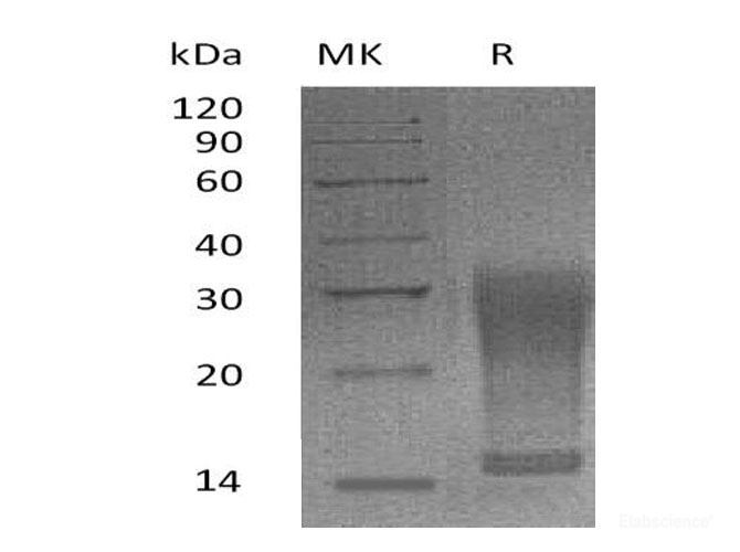 Recombinant Mouse Interleukin-13/IL-13 Protein(Ser26-Phe131,C-6His)-Elabscience