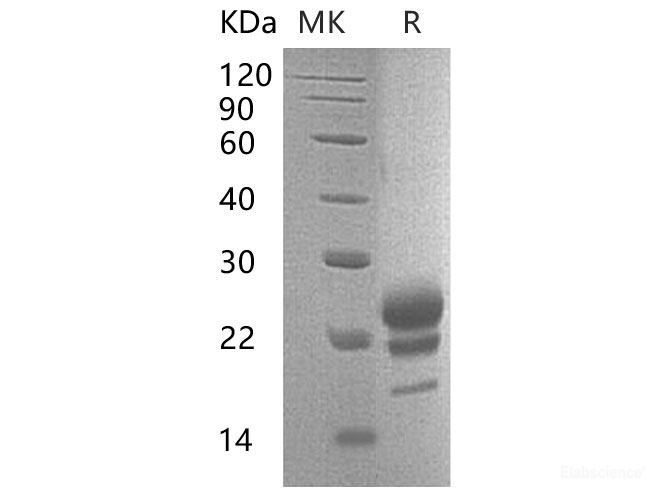 Recombinant Mouse Interleukin-17F/IL-17F Protein(C-6His) -Elabscience