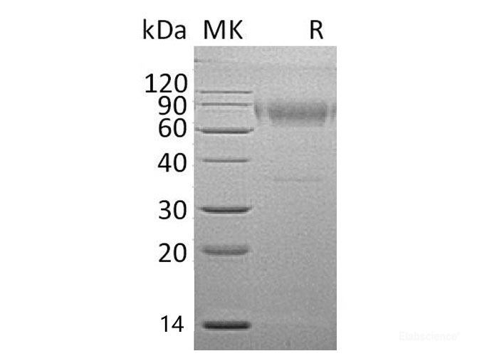 Recombinant Mouse Interleukin-18 Binding Protein Isoform d/IL-18 BPd Protein(C-Fc) -Elabscience