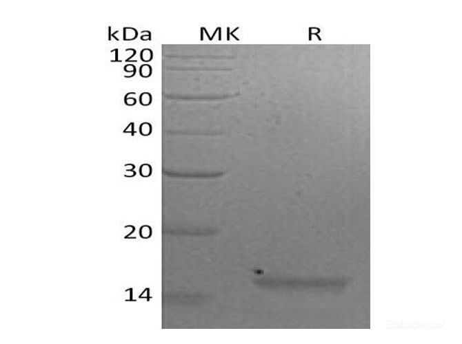 Recombinant Mouse Interleukin-21/IL-21Protein-Elabscience
