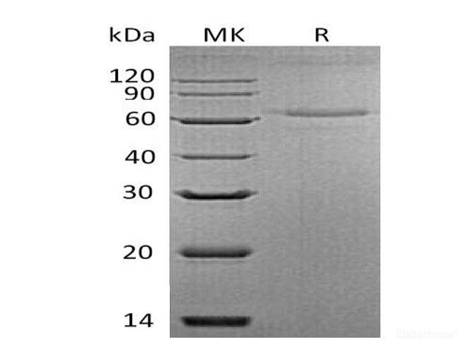 Recombinant Mouse Interleukin-27/IL-27 Protein(C-6His) -Elabscience