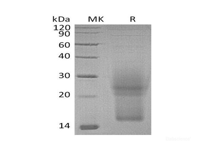 Recombinant Mouse Interleukin-3/IL-3 Protein(C-6His) -Elabscience