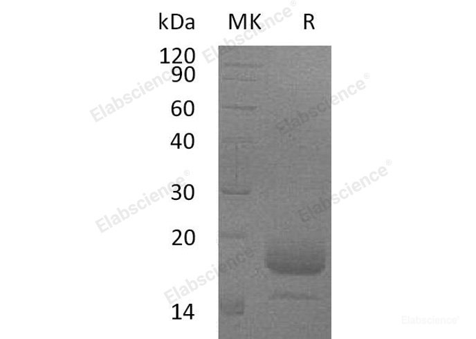 Recombinant Mouse Interleukin-4/IL-4 Protein(C-6His) -Elabscience
