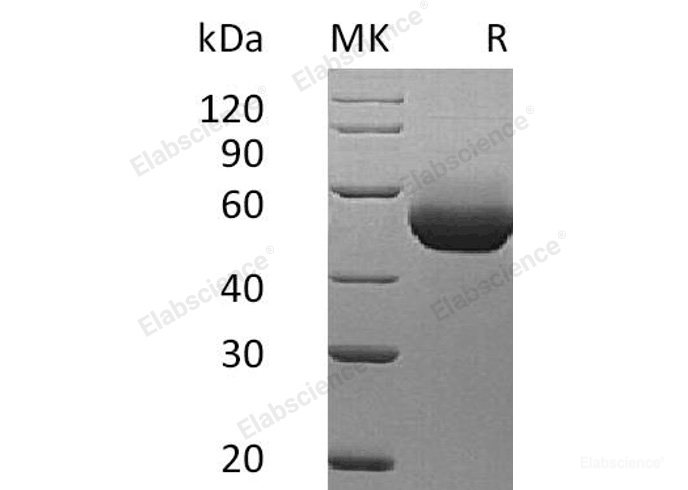 Recombinant Mouse Interleukin-5 Receptor Subunit Alpha/IL-5 Rα Protein(C-6His) -Elabscience
