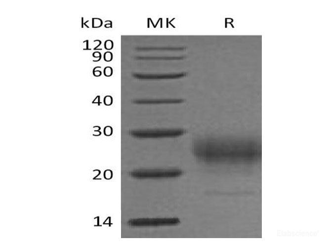 Recombinant Mouse Interleukin-7/IL-7 Protein(C-6His)-Elabscience
