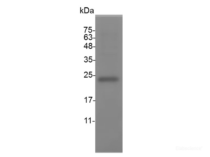 Recombinant Mouse Leukemia Inhibitory Factor/lIFProtein-Elabscience