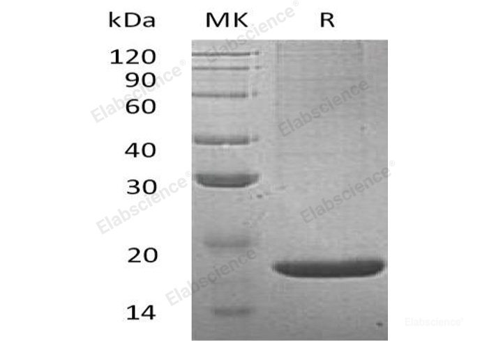 Recombinant Mouse Lithostathine-2/Reg2 Protein(N-6His)-Elabscience
