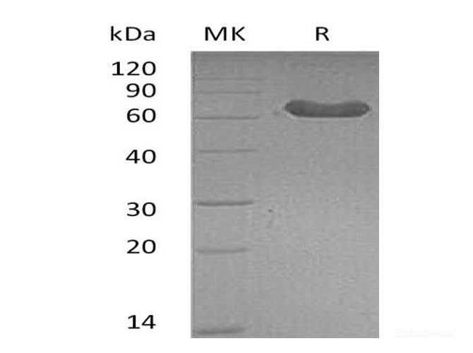 Recombinant Mouse Lymphotoxin β Receptor/LTBR/TNFRSF3/TNFRrp Protein(C-Fc)-Elabscience