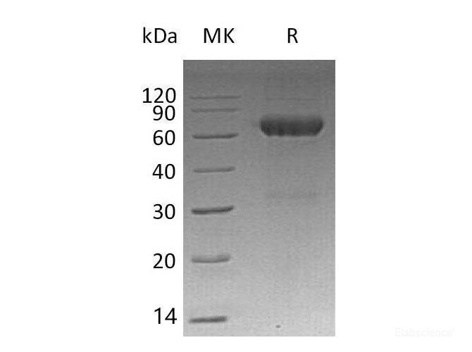 Recombinant Mouse Macrophage Metalloelastase/MMP12 Protein(C-6His)-Elabscience