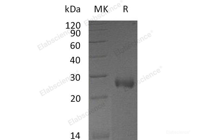 Recombinant Mouse Neuroblastoma Suppressor of Tumorigenicity 1/NBL1 Protein(C-6His) -Elabscience