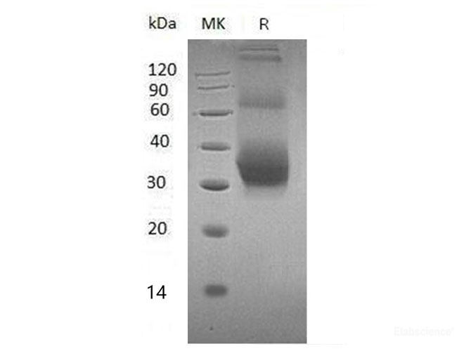 Recombinant Mouse NKG2D Ligand 1/NKG2DL/ULBP1 Protein(C-6His)-Elabscience