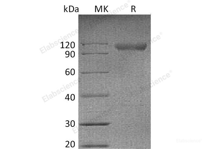 Recombinant Mouse Nogo-66 Receptor/Reticulon 4 Receptor/NgR/RTN4R Protein(C-Fc) -Elabscience