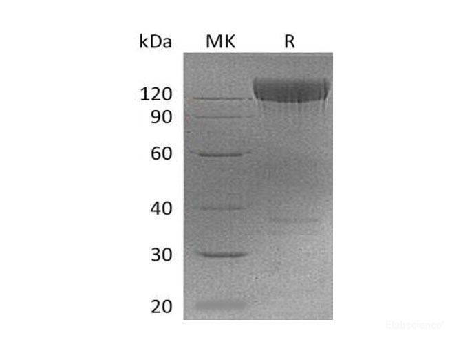 Recombinant Mouse PDGF R α/PDGFRA/CD140a Protein(C-Fc) -Elabscience