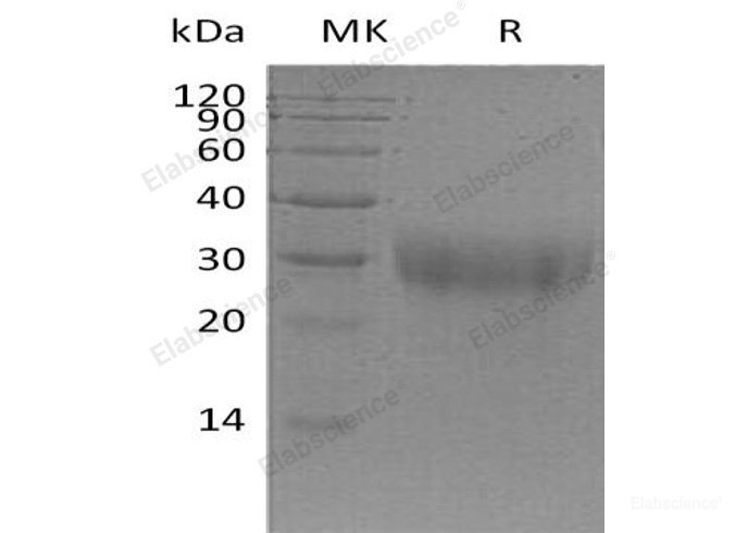 Recombinant Mouse Placenta Growth Factor/PGF/PIGF Protein(C-6His)-Elabscience