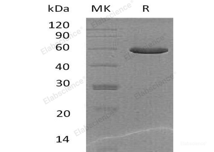 Recombinant Mouse Plasma Glutamate Carboxypeptidase/PGCP Protein(C-6His)-Elabscience