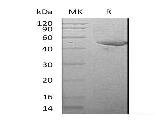 Recombinant Mouse Plasminogen Activator Inhibitor 1/PAI-1/SERPIN E1 Protein(C-6His)-Elabscience