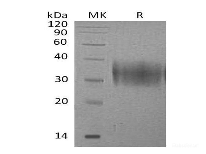 Recombinant Mouse Platelet Receptor Gi24/VISTA/B7-H5 Protein(C-6His) -Elabscience
