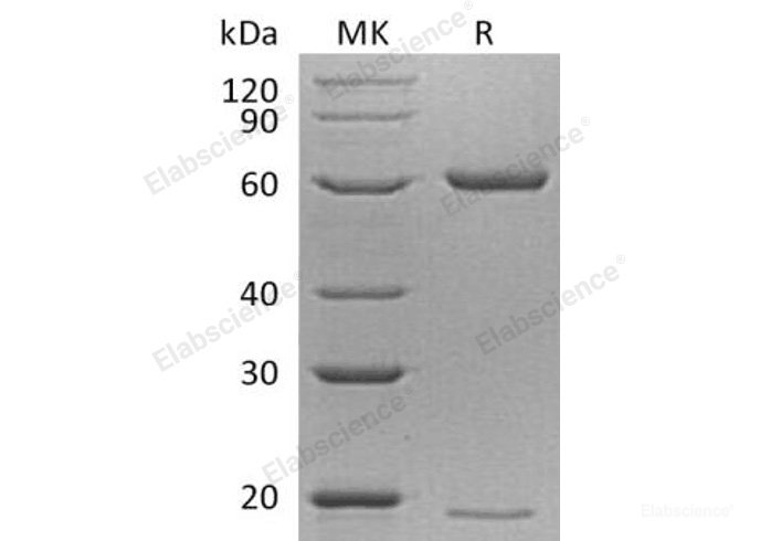 Recombinant Mouse Proprotein Convertase Subtilisin/Kexin Type 9/PCSK9 Protein(C-6His)-Elabscience