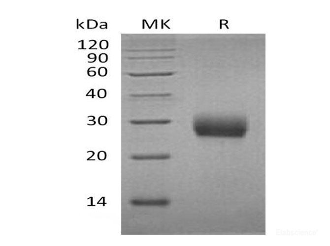 Recombinant Mouse RANK/TNFRSF11A Protein(C-6His) -Elabscience