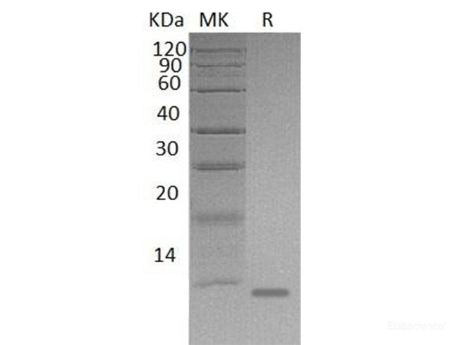 Recombinant Mouse S100 Calcium Binding Protein A8/S100A8 Protein(C-6His)-Elabscience