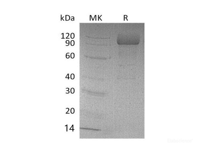Recombinant Mouse Scavenger Receptor B2/SR-B2/LIMPII/CD36L2 Protein(N-6His) -Elabscience