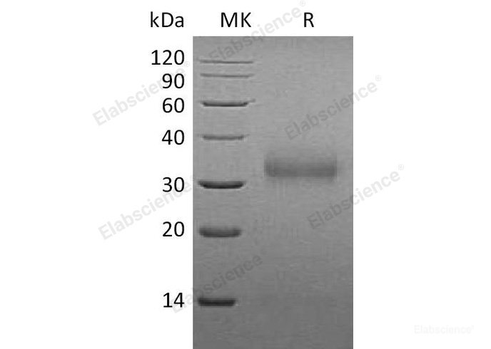 Recombinant Mouse Sclerostin/SOST Protein(C-6His) -Elabscience
