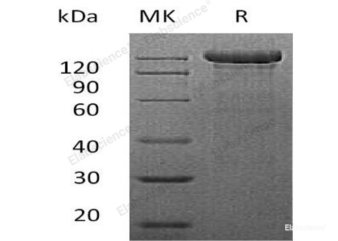 Recombinant Mouse Semaphorin 4C/SEMA4C Protein(C-Fc)-Elabscience