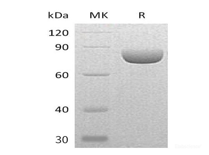 Recombinant Mouse Semaphorin-4A/SEMA4A Protein(C-6His)-Elabscience