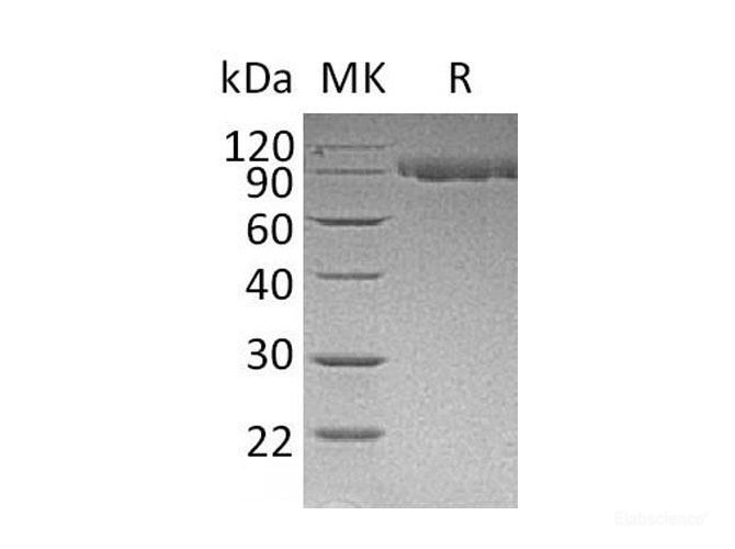 Recombinant Mouse Serpin G1/C1 Inhibitor Protein(C-6His)-Elabscience