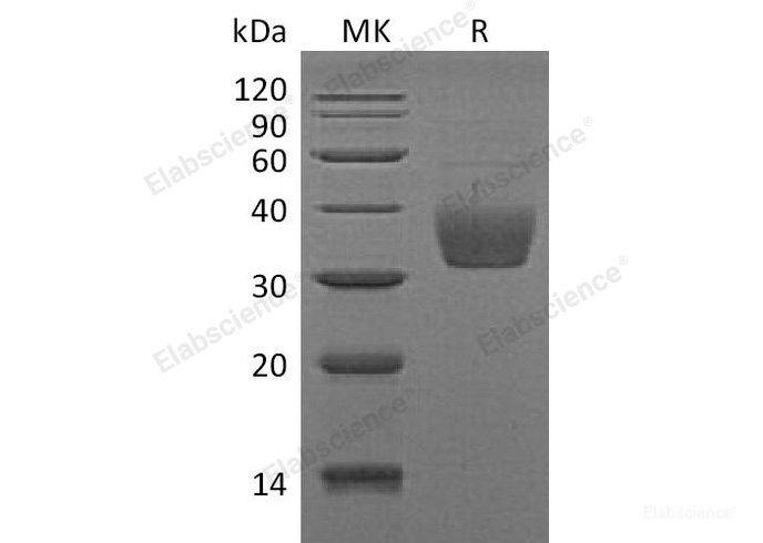 Recombinant Mouse SLAM Family Member 8/SLAMF8 Protein(C-6His) -Elabscience