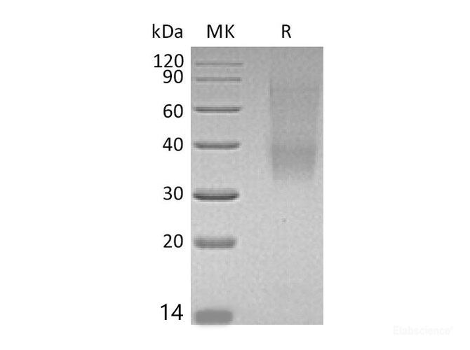 Recombinant Mouse SLAM Family Member 9/SLAMF9/CD2F-10 Protein(C-6His)-Elabscience