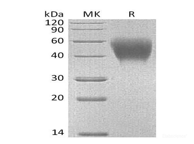 Recombinant Mouse SLAM/CD150 Protein(C-6His) -Elabscience