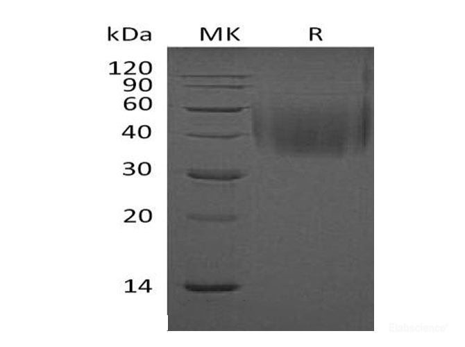 Recombinant Mouse SLAMF4/Natural killer cell receptor 2B4/CD244 Protein(C-6His) -Elabscience