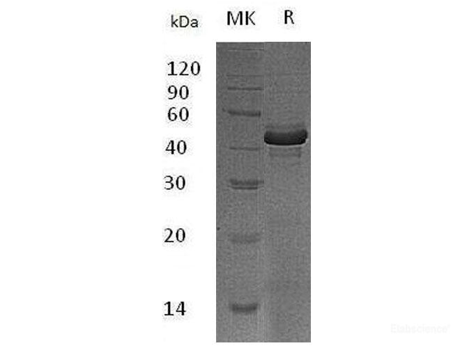 Recombinant Mouse TACI/TNFRSF13B/CD267 Protein(C-Fc)-Elabscience