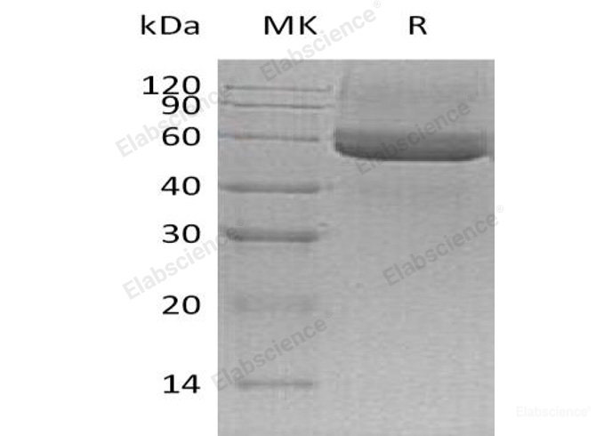 Recombinant Mouse Testican-3/SPOCK3 Protein(C-6His)-Elabscience