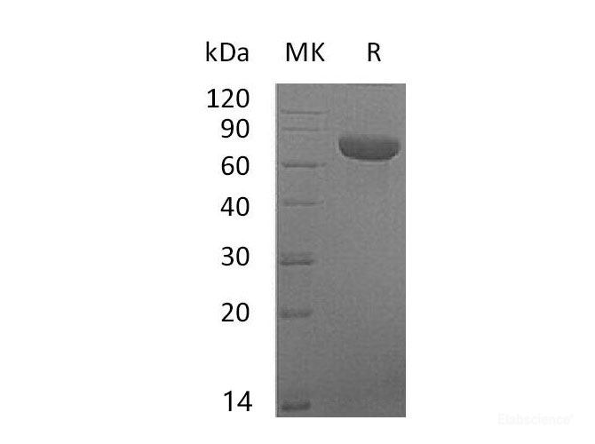 Recombinant Mouse Thymic Stromal Lymphopoietin Receptor/TSP R Protein(C-Fc) -Elabscience
