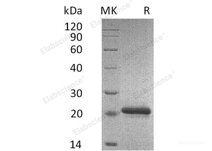 Recombinant Mouse Tissue Inhibitor of Metalloproteinases 2/TIMP-2 Protein(C-6His)-Elabscience