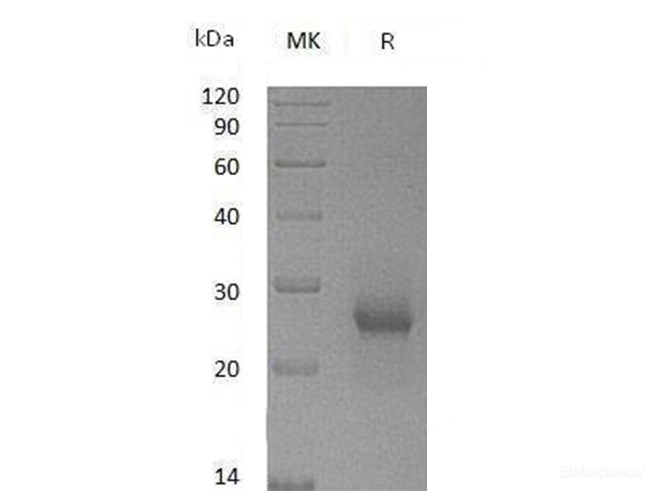 Recombinant Mouse Tissue Inhibitors of Metalloproteinases 1/TIMP1   Protein-Elabscience
